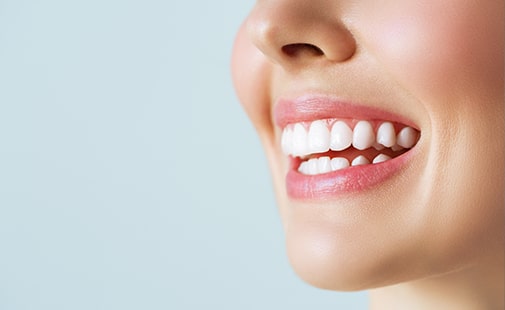 Mckennell Dental Practice Teeth Whitening